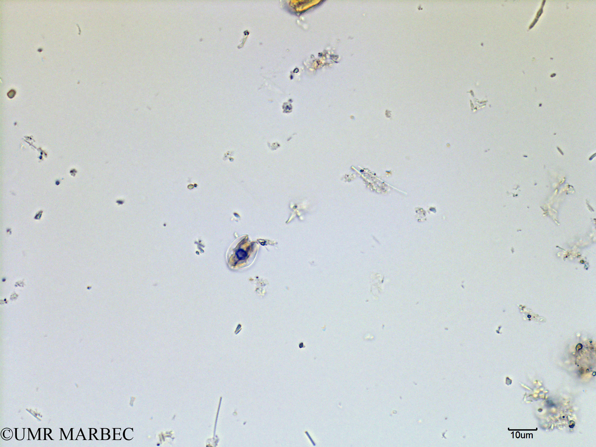 phyto/Scattered_Islands/mayotte_lagoon/SIREME May 2016/Nanoflagellé 6 (MAY8_flagelle bdd-2).tif(copy).jpg